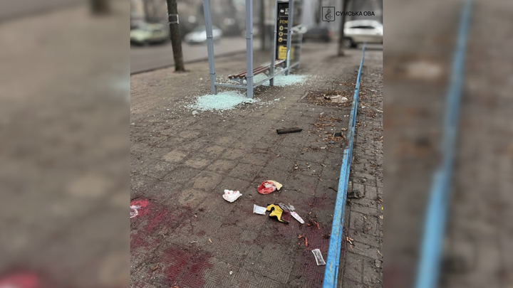 zupynka v sumakh na yakiy buv poranenyy khlopetsʹ зупинка в Сумах після російського обстрілу