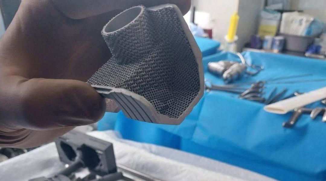 3D суглоб Суми ЦМКЛ